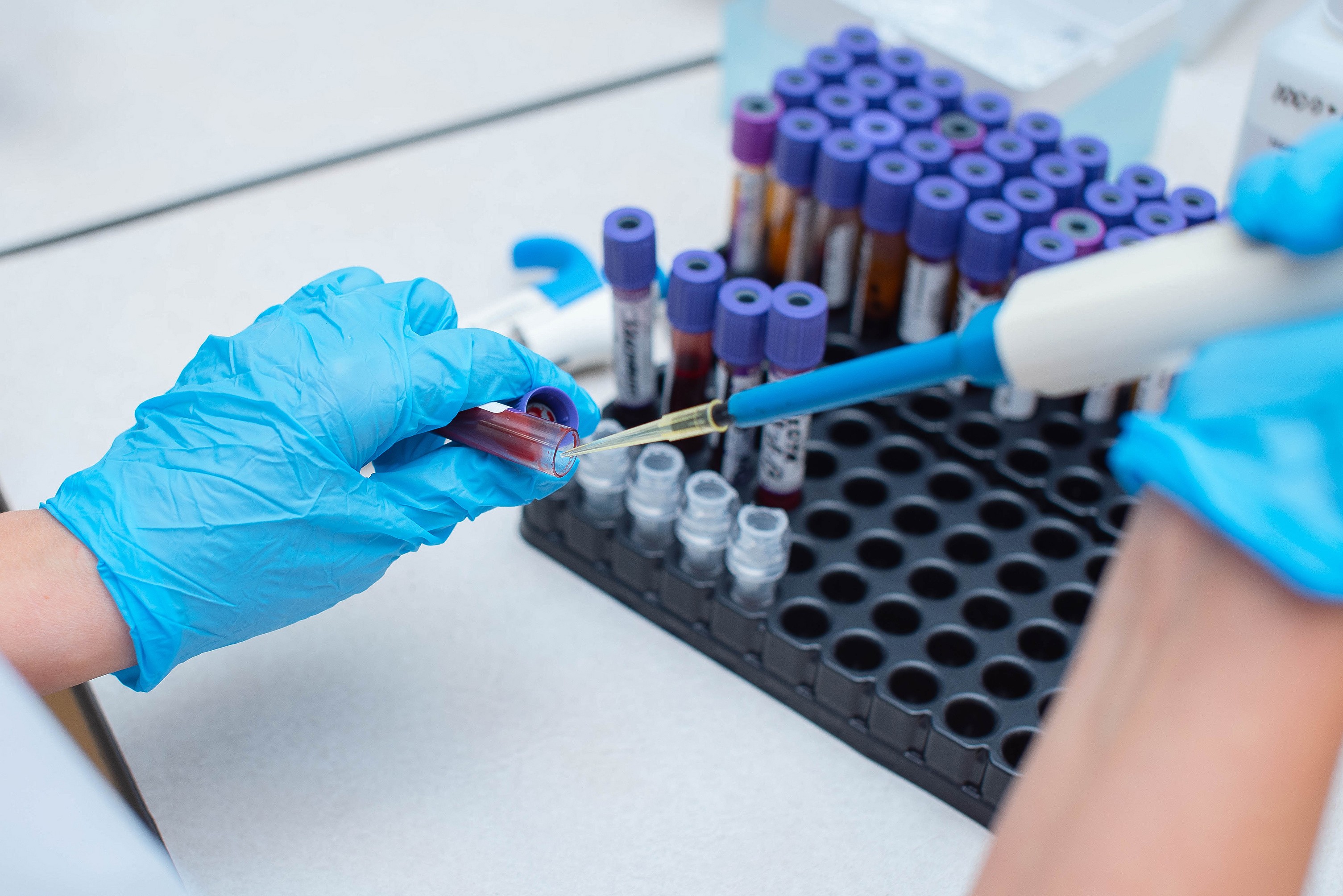 Blood test for earlier breast‑cancer detection showing test tubes being filled with blood samples.
