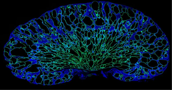 Mouse kidney with PKD